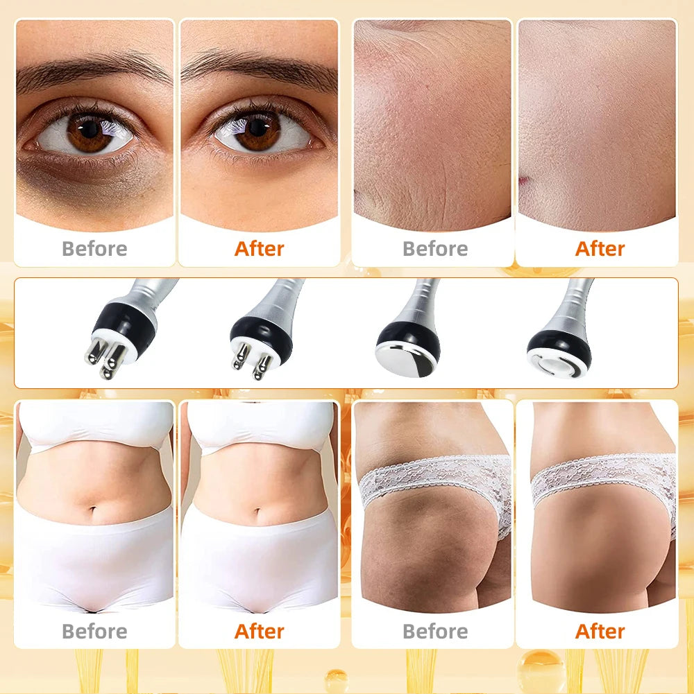 40K Cavitation Slimming Machine for Body Contouring and Skin Tightening Body Shaping Massage Equipment Tidesmit
