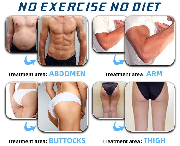 EMS Body Slimming Machine for Muscle Sculpting and Fat Reduction Relaxation Treatment Tidesmit