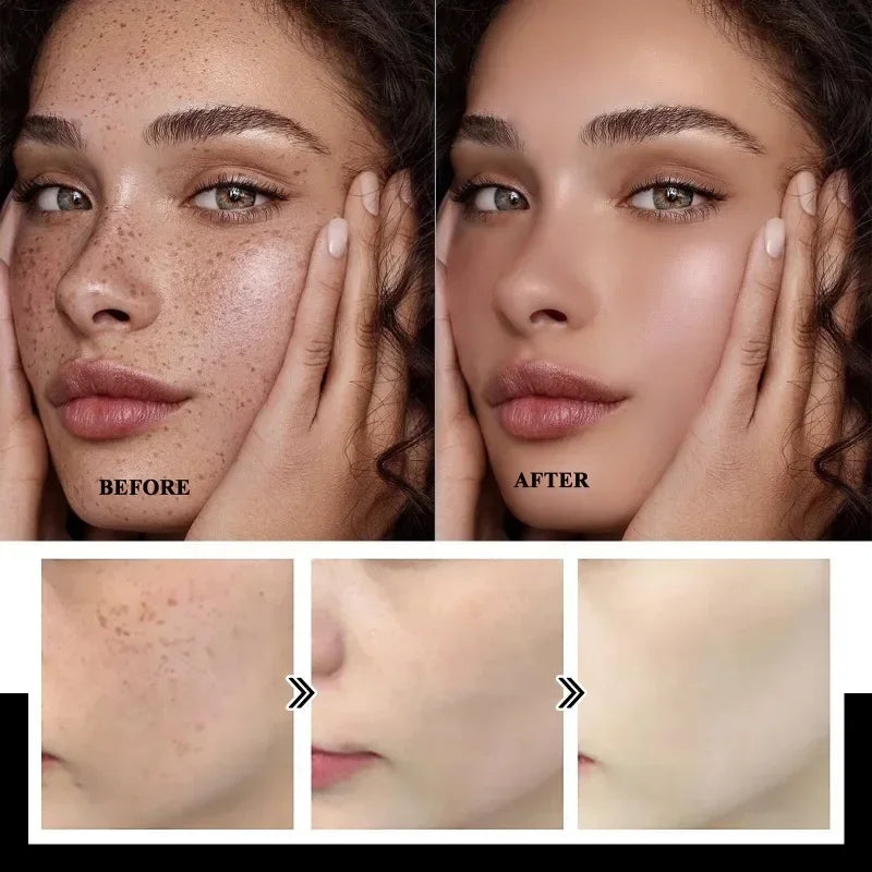 Tidesmit niacinamide melasma lightening cream texture close-up for fading dark spots and hyperpigmentation