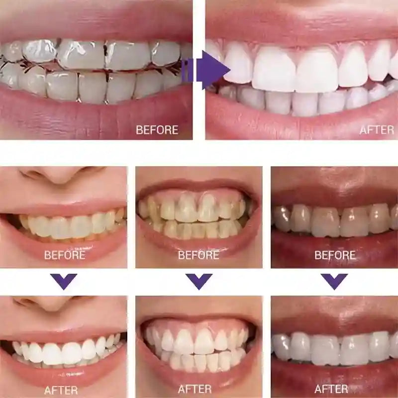 Tidesmit teeth whitening toothpaste gel for effective stain removal and fresh breath 2025 formula