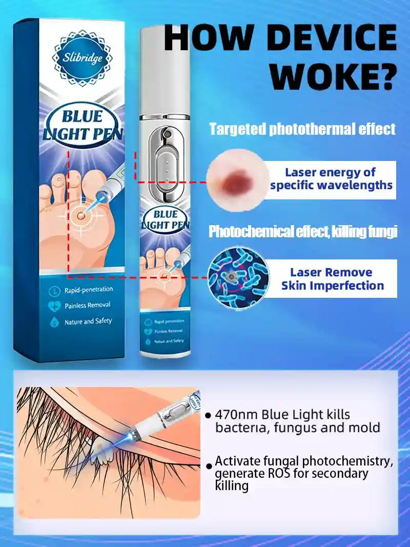 Blue Light Wart Removal Pen - Non-Invasive Skin Care Tool | Tidesmit Lip Care Tidesmit