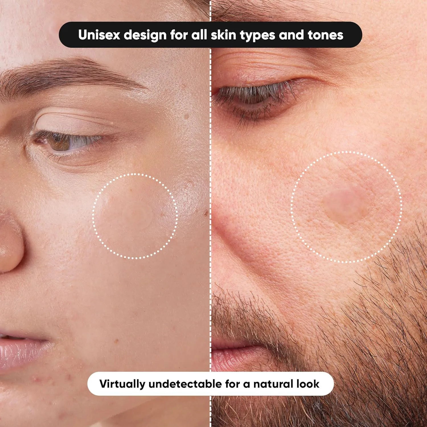 Hydrocolloid acne patch facial cleansing care essence, tool accessory, invisible and waterproof, suitable for all skin types