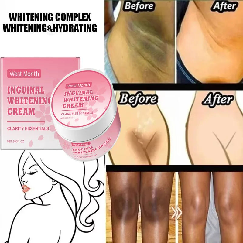 Body Whitening Niacinamide Brighten Cream For Intimate Parts Underarm Bleach Knees Lighten Thigh Inner Korean Skin Care Products