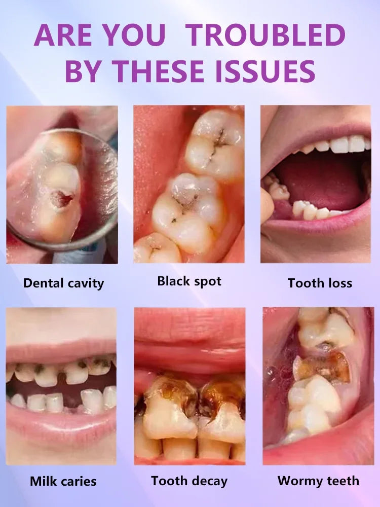 Tidesmit anti-caries teeth whitening treatment for healing cavities and strengthening enamel