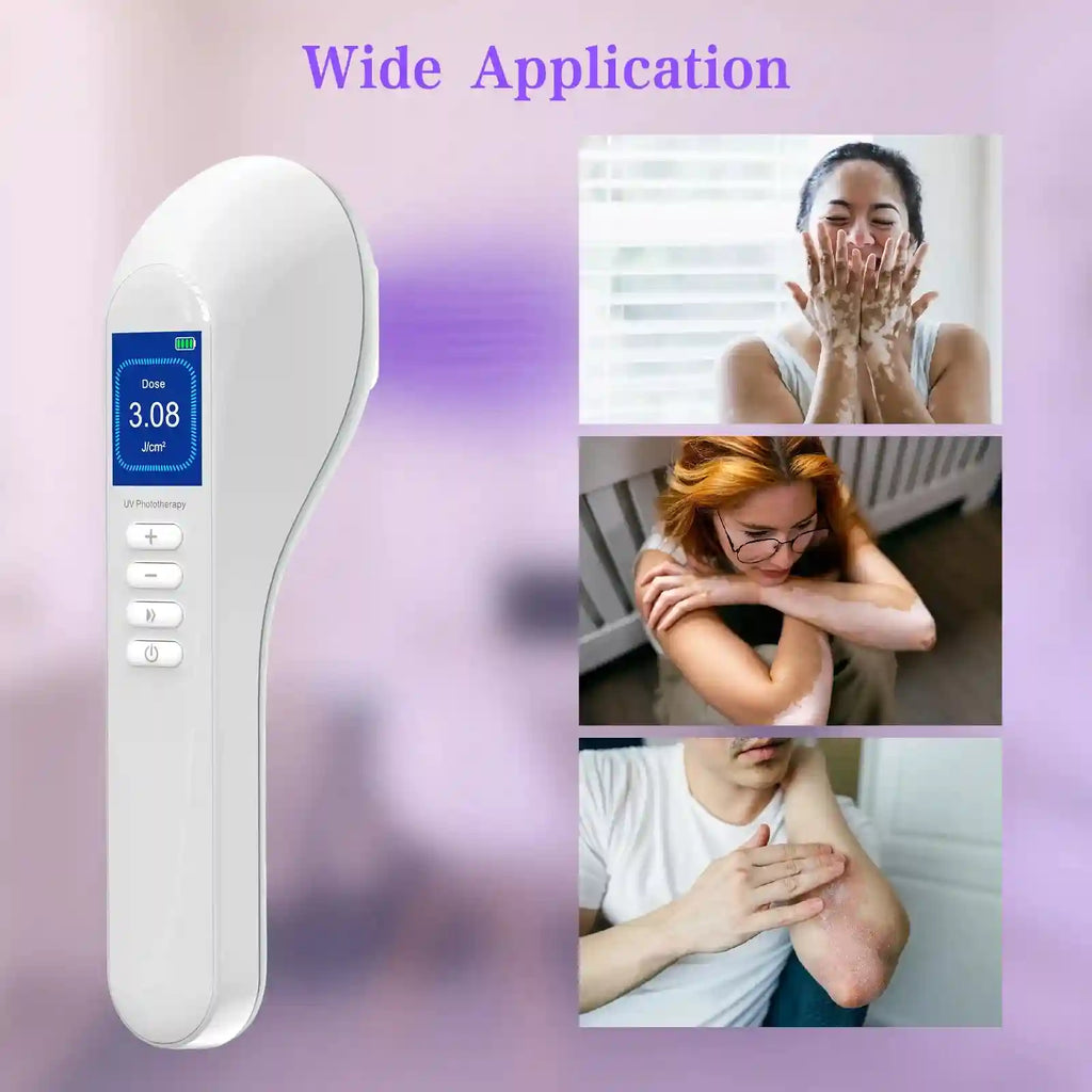 White handheld UV phototherapy device with digital display and buttons for skin condition treatment.