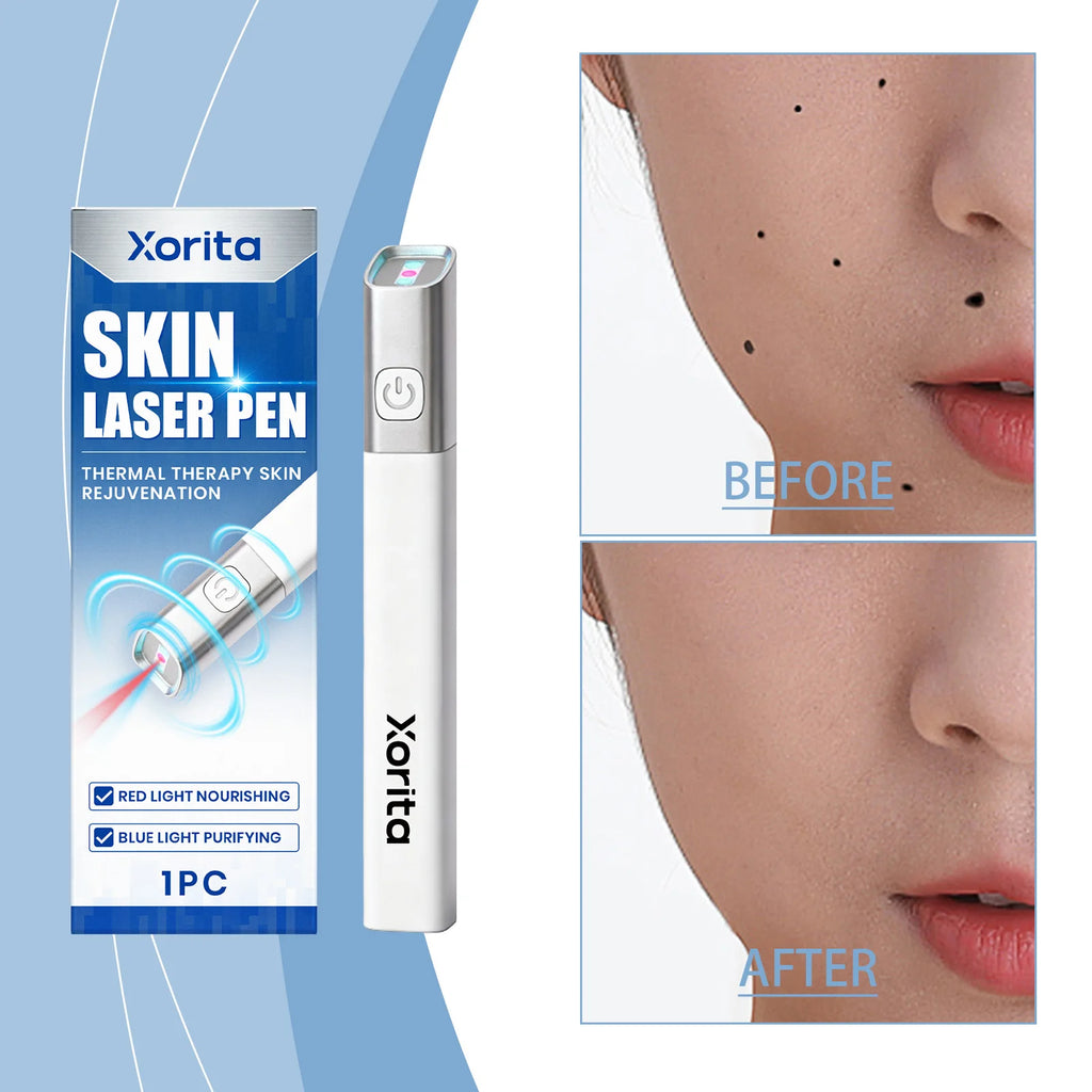 Xorita plasma pen for skin tag, freckle, and mole removal with before and after results on face, white handheld device.