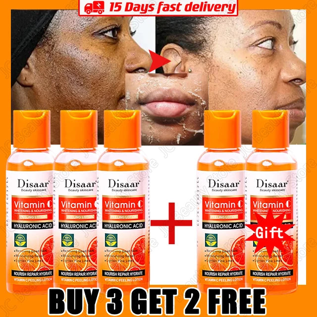 Yellow Peeling Oil for Dark Skin - 100ml Professional Exfoliating Treatment Scrubs Treatments 100ml-5PCS Tidesmit