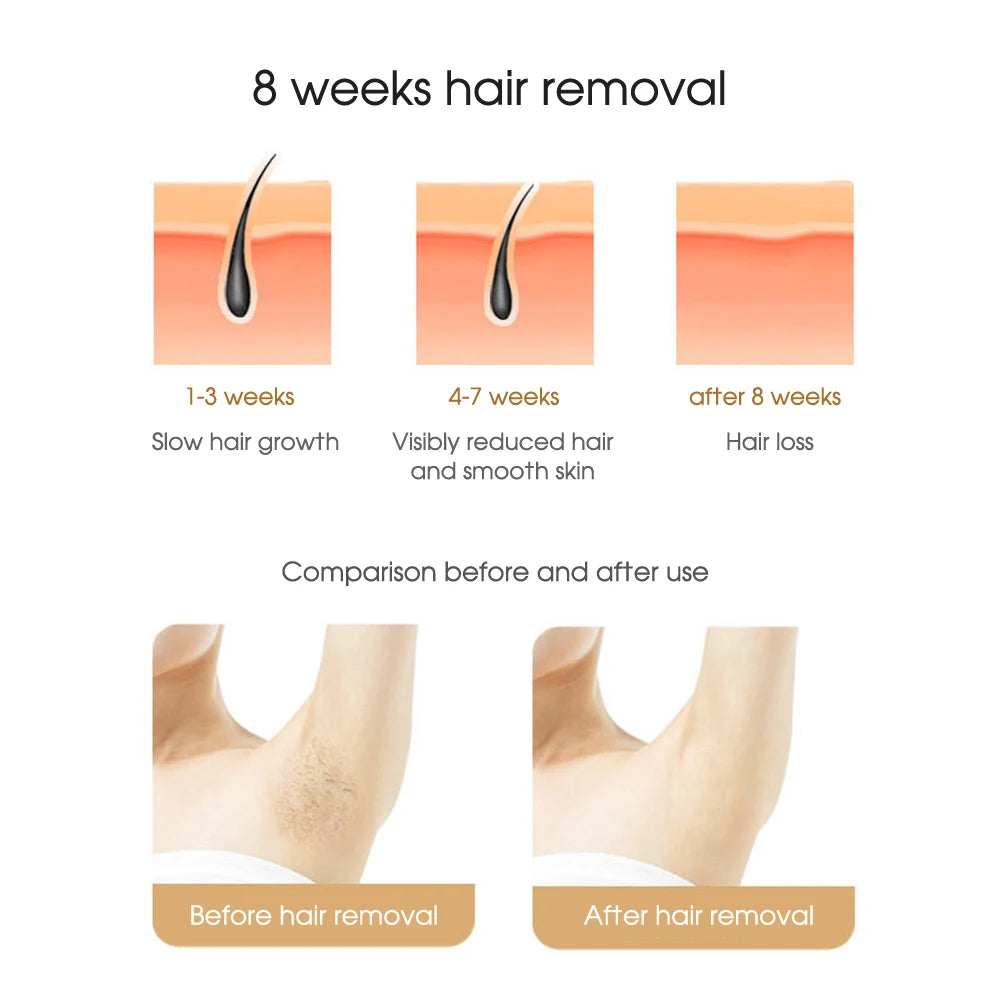 IPL laser hair removal results showing 8-week progress for smooth underarm skin using home epilator device.