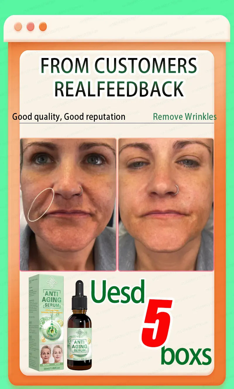 Tidesmit anti-aging serum for wrinkle removal, before and after skin treatment results for youthful, firm skin.