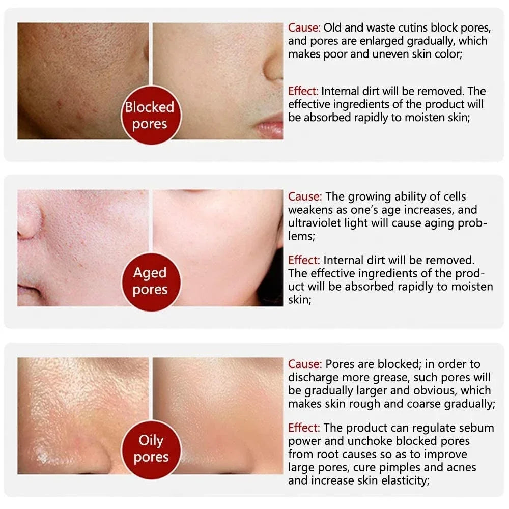 Retinol Niacinamide Serum - Professional PMU Machine Pore Refining Permanent Makeup Machines Tidesmit