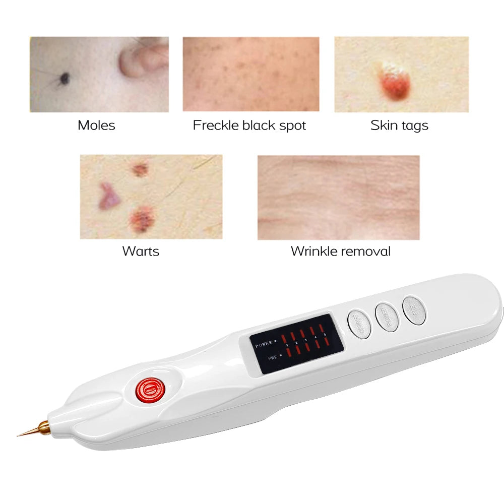 Portable white plasma skin pen for removing moles, warts, freckles, skin tags, and dark spots at home.