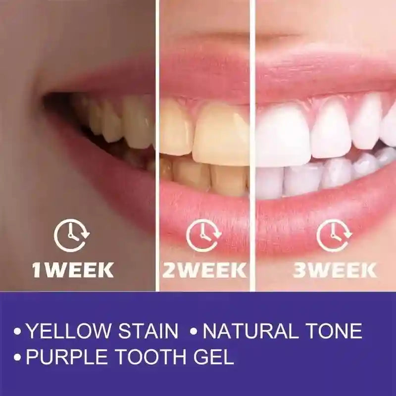 Tidesmit teeth whitening toothpaste gel for deep stain removal and fresh breath, 2025 Korean dental care formula