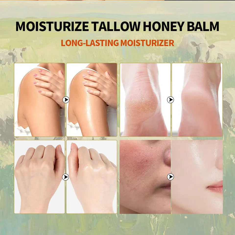 Beef Tallow And Honey Balm Moisturizing Whipped Beef Tallow Face Cream Body Lotion Grass Fed Grass Finished Face Cream Care