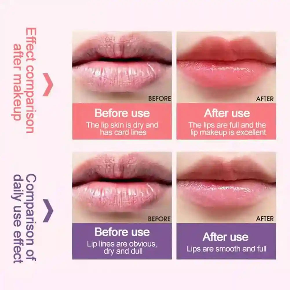 Strawberry Lip Balm Set: Hydrating Lip Treatment & Jelly Mask (2PCS) Lip Care Tidesmit