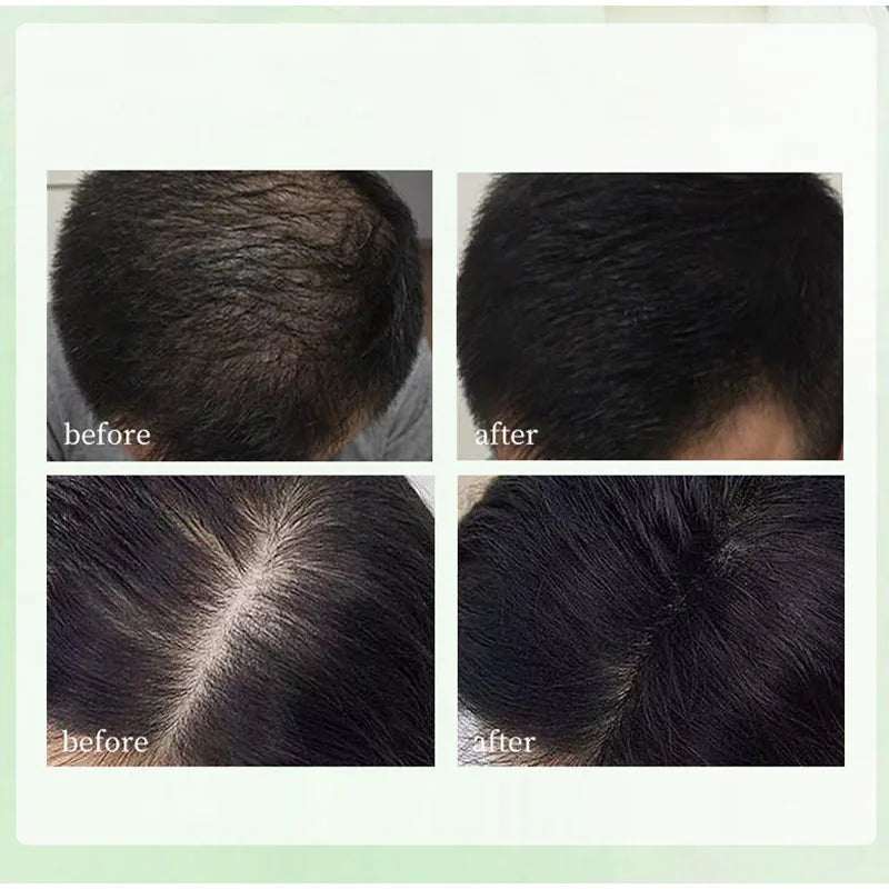 Hair Strengthening Nourishing Shampoo Soap,Oriental Arborvitae Usman Herbal Extract Anti Hair Loss,Face Wash Clean Handmade Soap