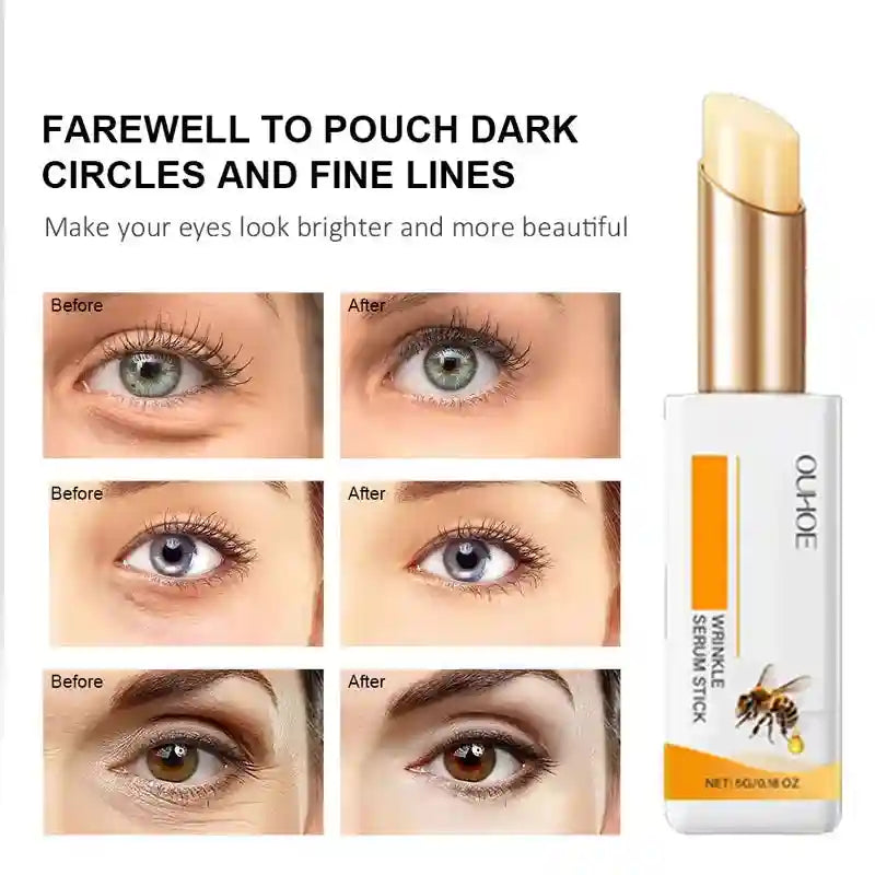 Anti Wrinkle Eye Cream for Dark Circles and Puffiness | Tidesmit EU Scrubs Treatments Tidesmit