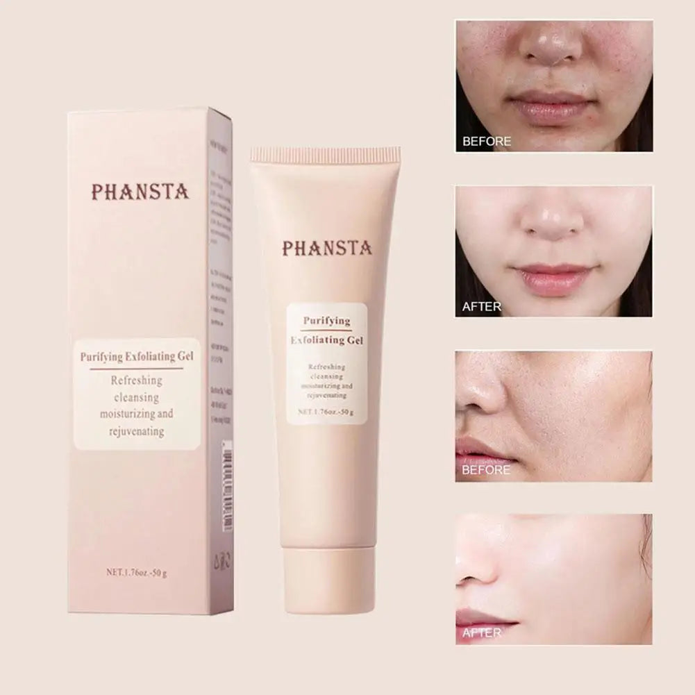 Face Exfoliating Gel for Deep Pore Cleansing and Oil Control - 50g Scrubs Treatments Tidesmit