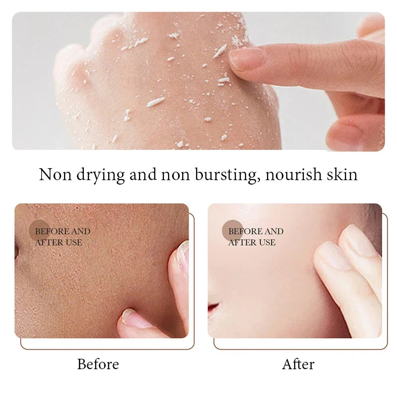 White Rice Face Exfoliating Gel | Gentle Hydrating Pore Refiner Scrubs Treatments Tidesmit