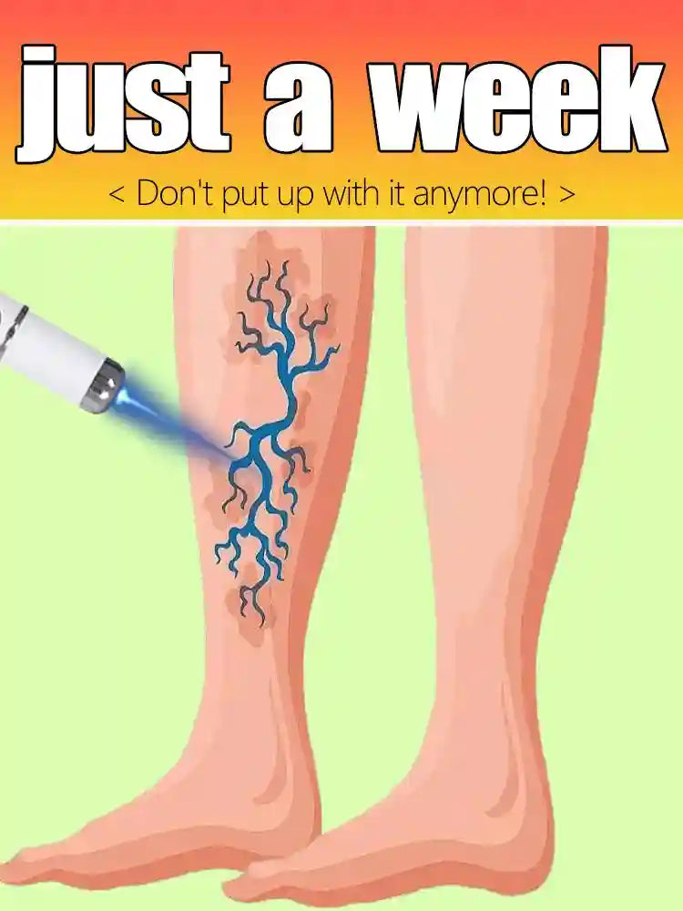 Handheld blue laser device for painless varicose vein removal on legs, home care medical tool for spider veins.