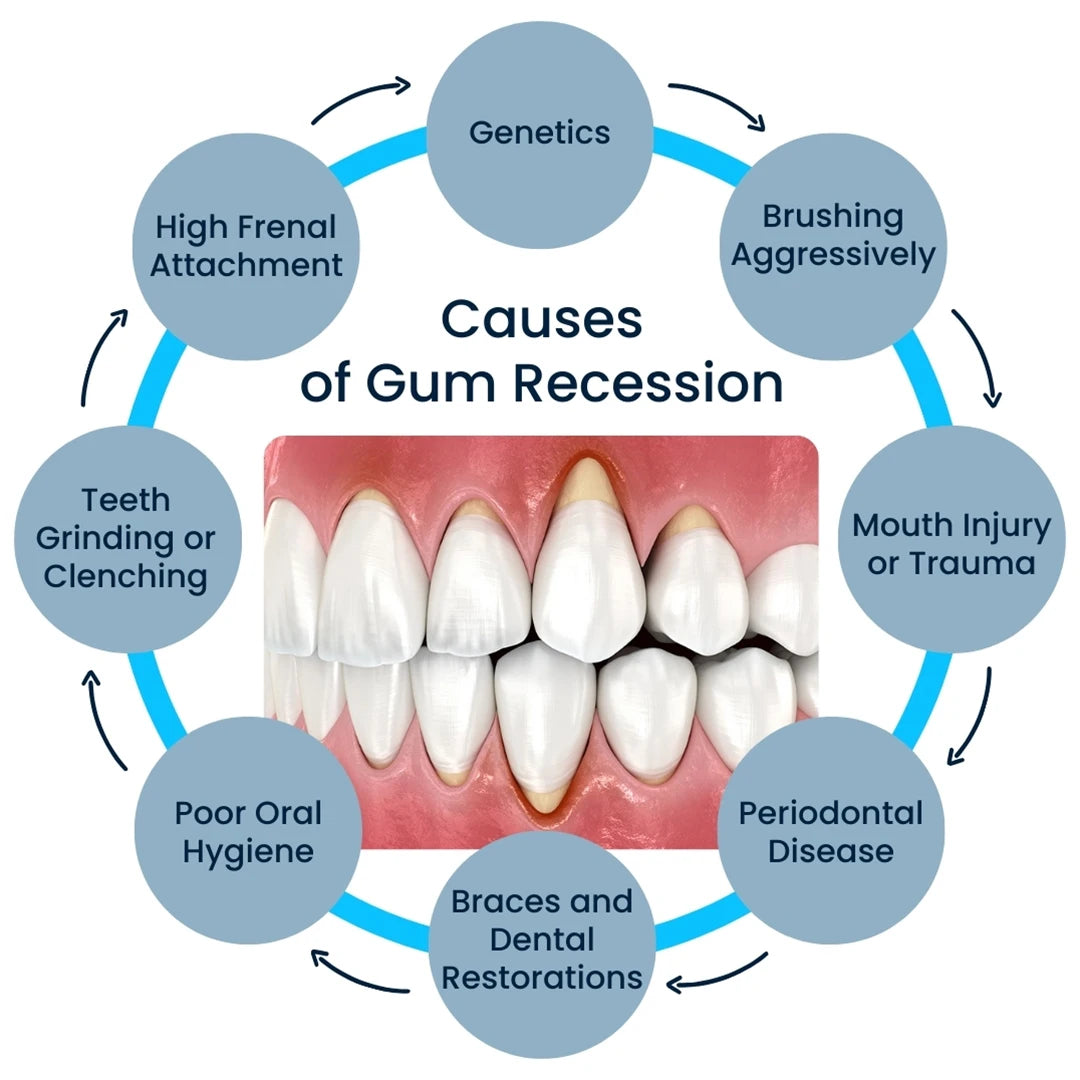 Tidesmit gum repair gel for sore gums and teeth stain removal deep cleaning dental treatment serum