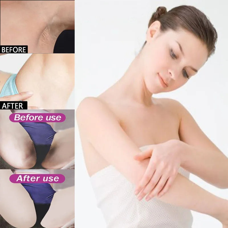 Remove Melanin Nicotinamide Brightening Cream For Dark Skin Effective Lighten Thigh Inner Bleach Private Parts Brighten Cream