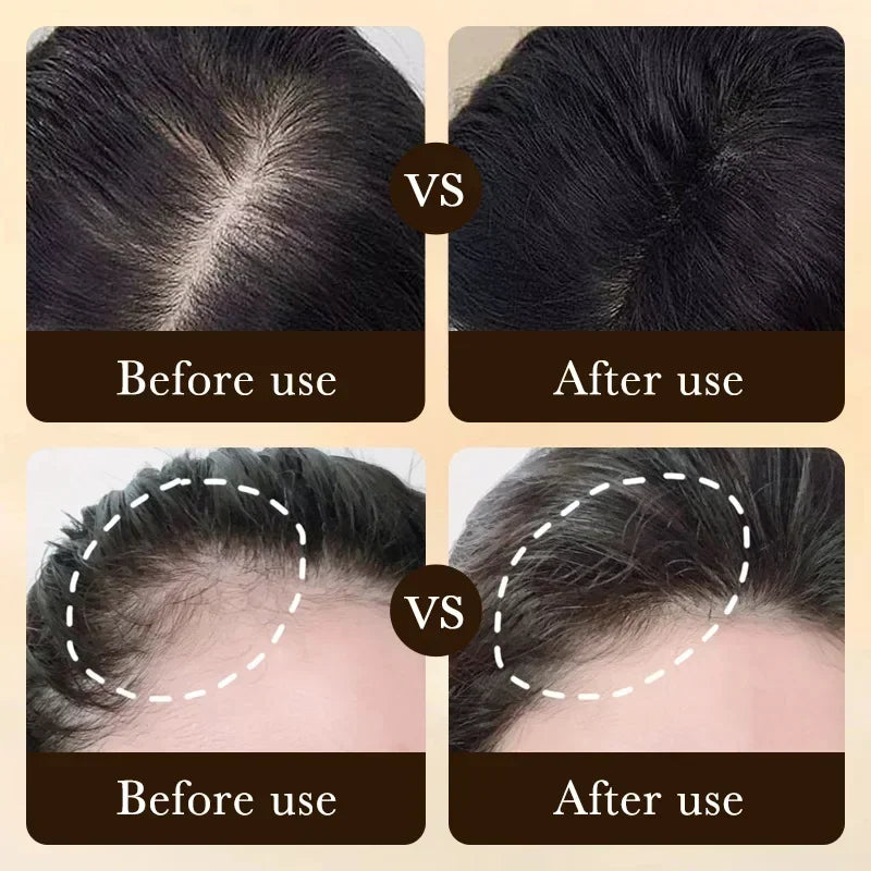 Tidesmit Biotin hair growth oil results showing before and after scalp treatment for thicker, anti-hair loss hair.