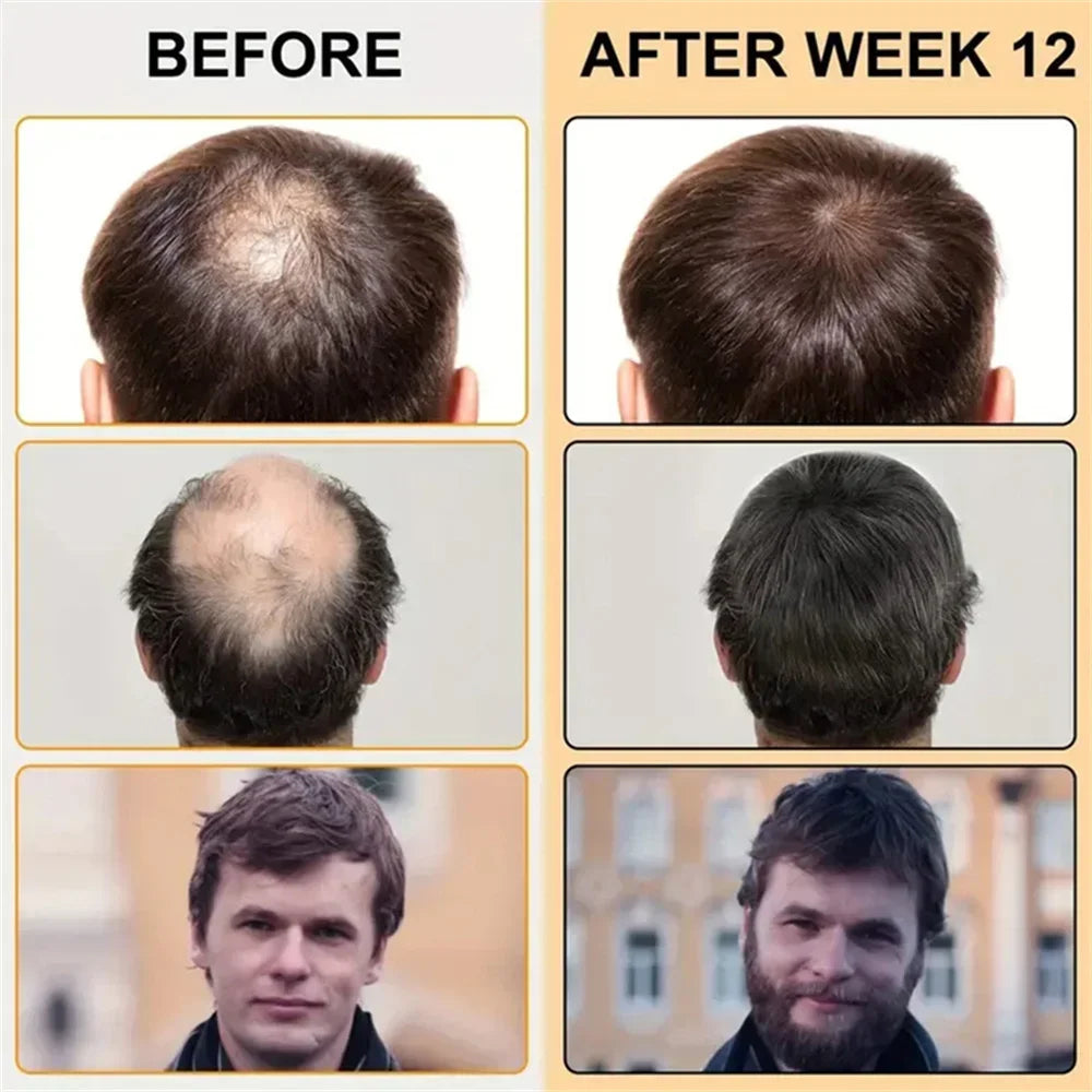Tidesmit Biotin hair growth oil: before and after results for thicker hair, anti-hair loss scalp treatment serum.