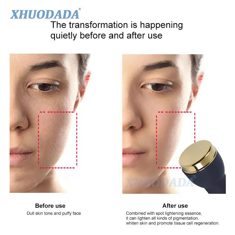 3-in-1 ultrasonic facial anti-aging device with gold head for skin brightening, spot removal, and face lifting results.