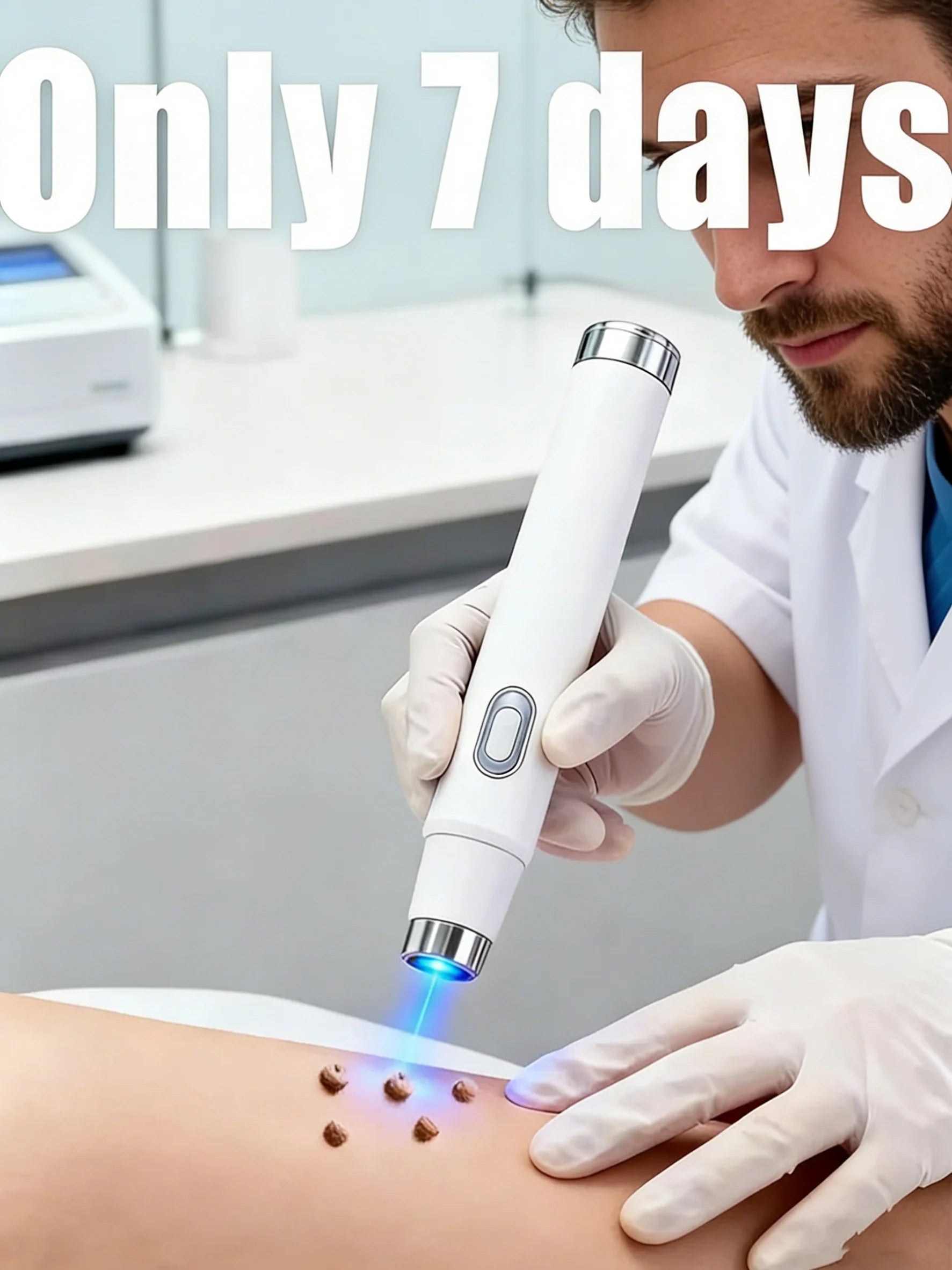 Portable white blue light wart and skin tag remover pen for painless at-home blemish and mole removal.