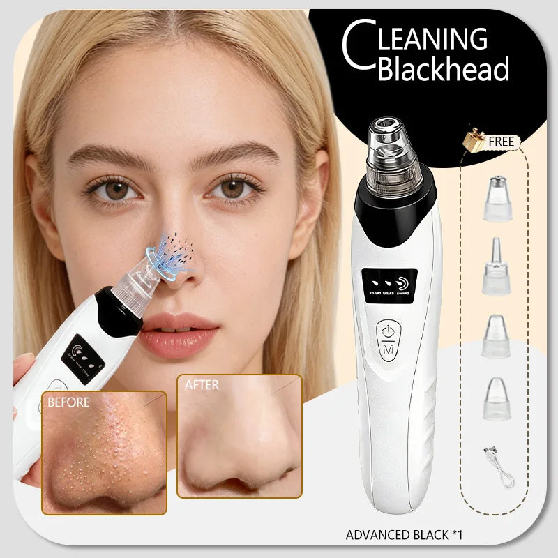 White and black electric facial pore vacuum with four detachable clear nozzles, shown with a person using the device.
