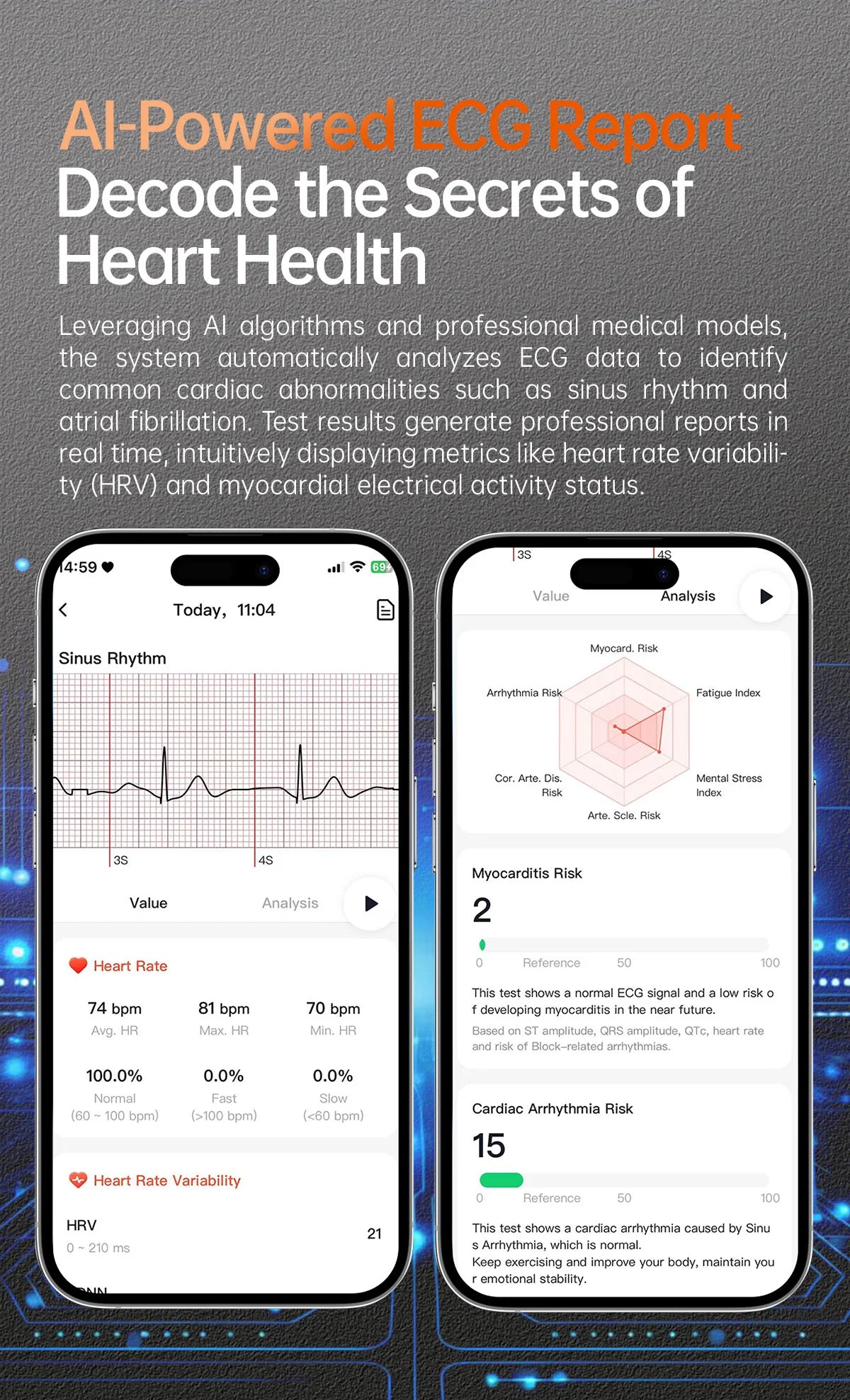 2026 New Health Analysis ECG+PPG Smart Watch Body Fat Uric Acid Blood Pressure Heart Rate Tracker NFC Smartwatch For Android IOS