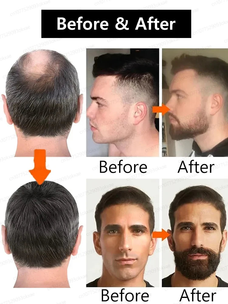 Beard Growth Liquid for Thicker Fuller Hair - Tidesmit Natural Formula Scrubs Treatments Tidesmit