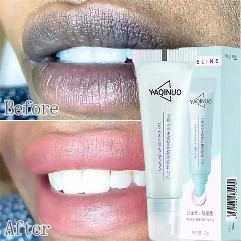 Lip Lightening Balm - Exfoliating Moisturizer for Dark Lips | Tidesmit Lip Care Tidesmit