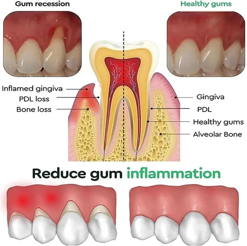 Tidesmit Rapid Repair Gum Serum for tooth sensitivity relief and dental caries cleaning