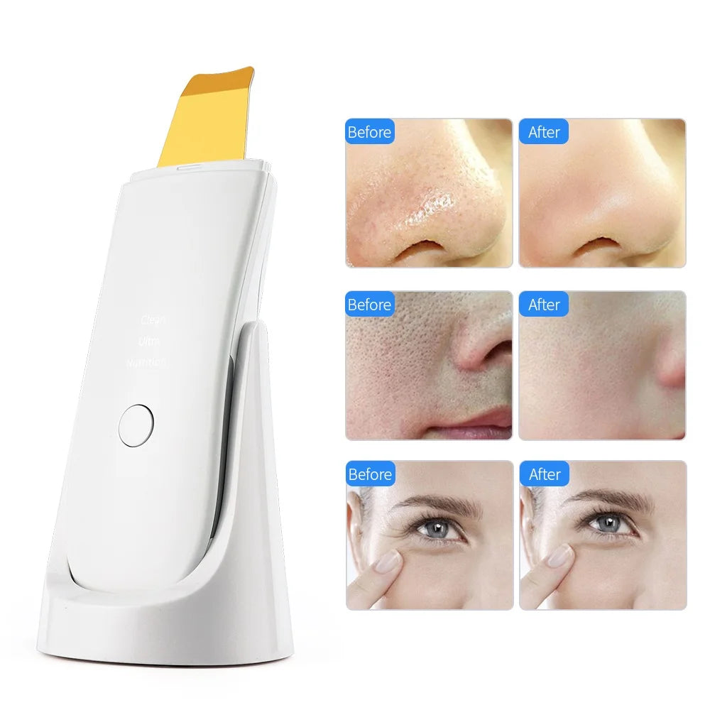 Ultrasonic Skin Scrubber | Nano Mist Deep Pore Cleansing Device (White) Scrubs Treatments Tidesmit