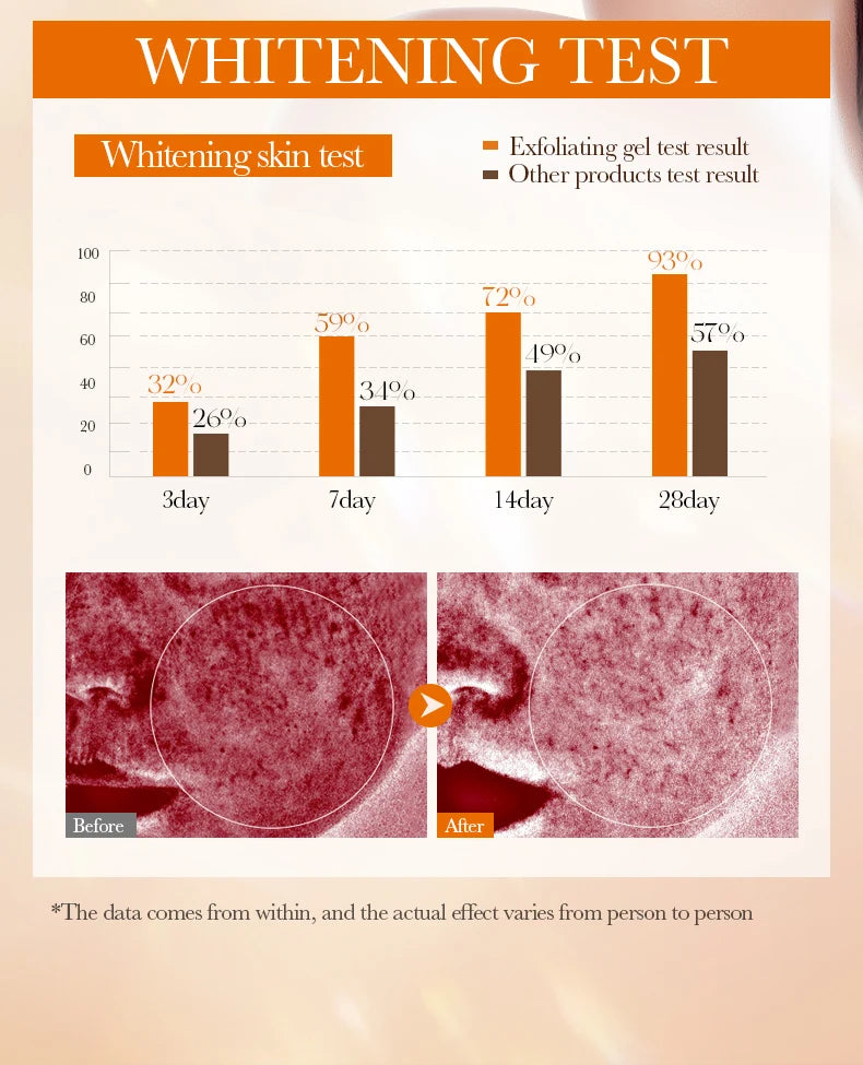 Orange Exfoliating Peeling Gel - Brightening Face Scrub 1pcs Scrubs Treatments Tidesmit