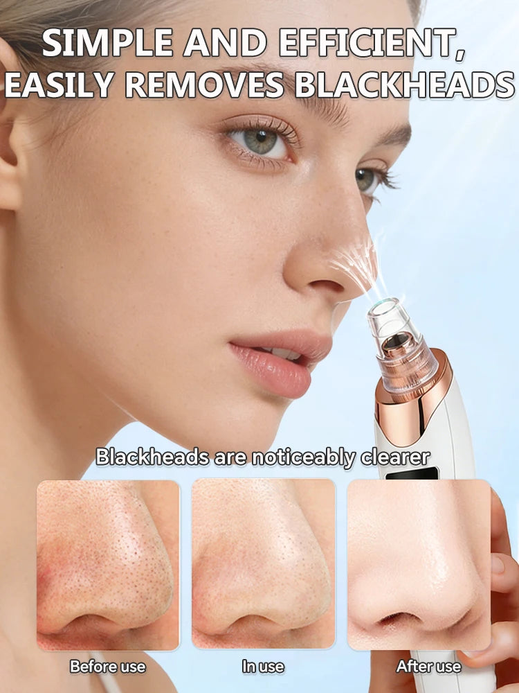 White and rose gold electric blackhead vacuum remover tool showing nose pore cleansing results before and after use.