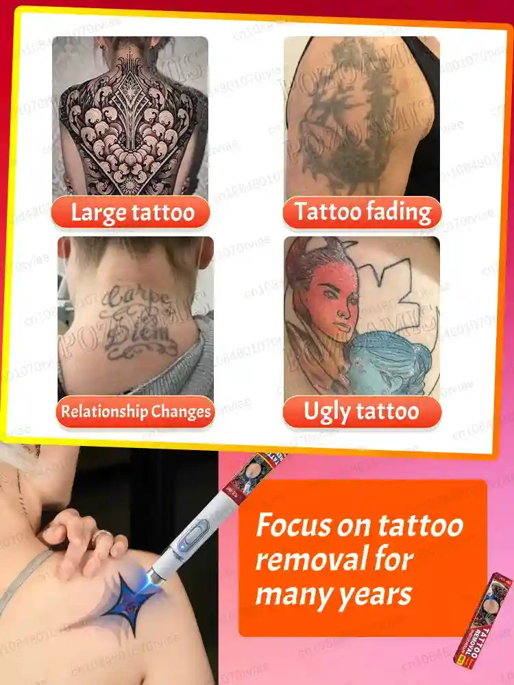 Tattoo Removal Cream - Painless Nano Laser Ink Eraser Treatment Scrubs Treatments Tidesmit