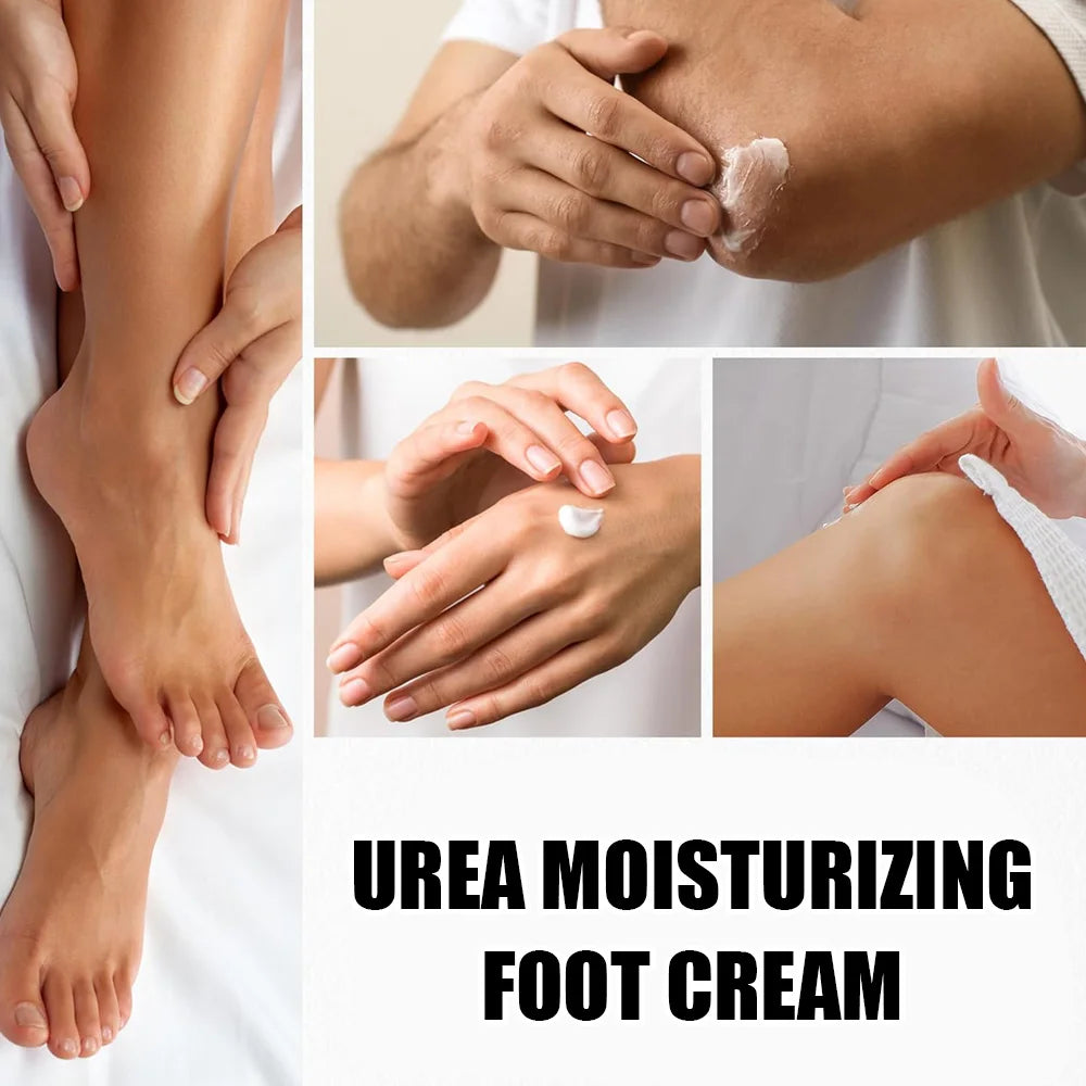 Urea 40% Cream for Cracked Heels and Dry Skin Repair - Tidesmit Scrubs Treatments Tidesmit