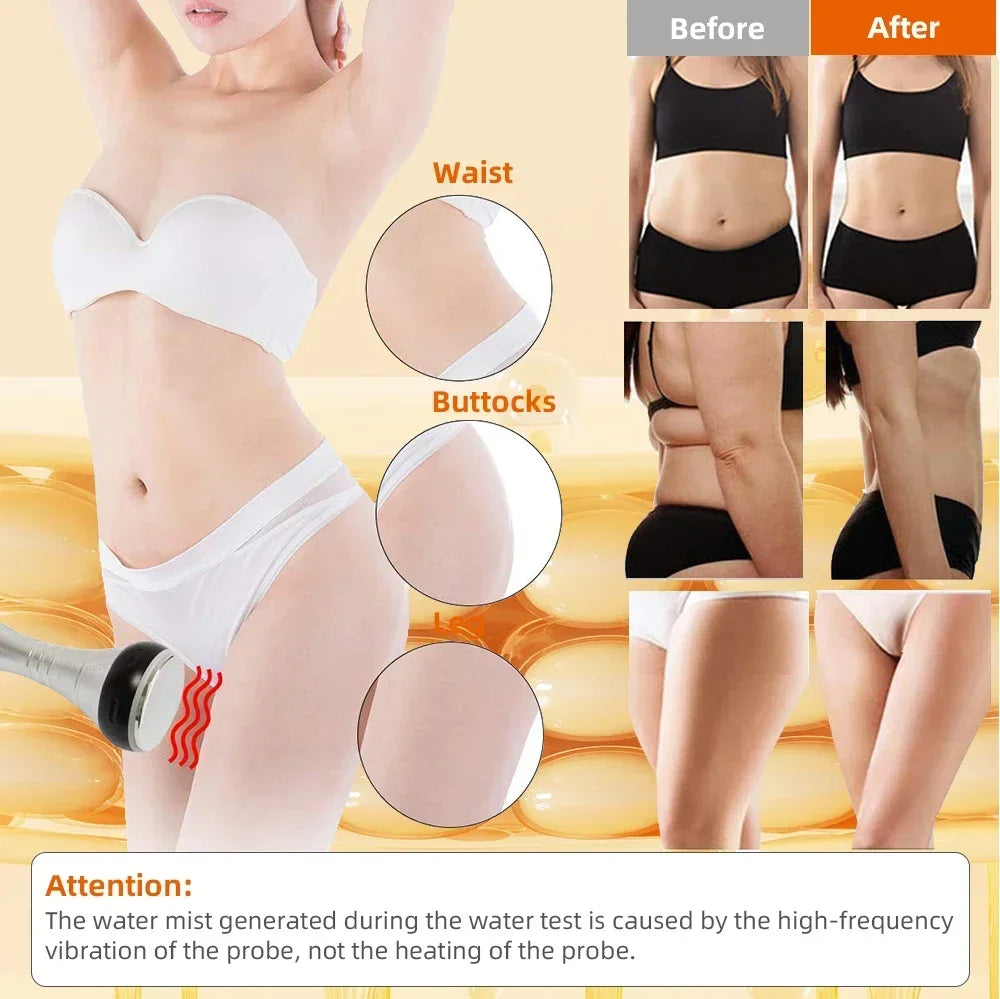 40K Ultrasonic Cavitation Machine for Targeted Body Firming Back Massage Instrument Tidesmit