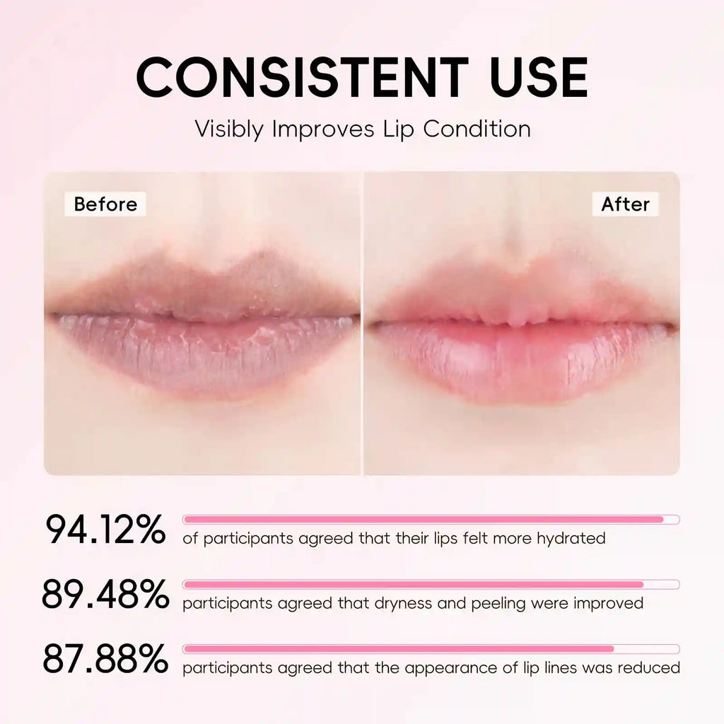 Sakura Lip Balm Hydrating Plumping Treatment 3.5g - Tidesmit Lip Care Lip Care Tidesmit