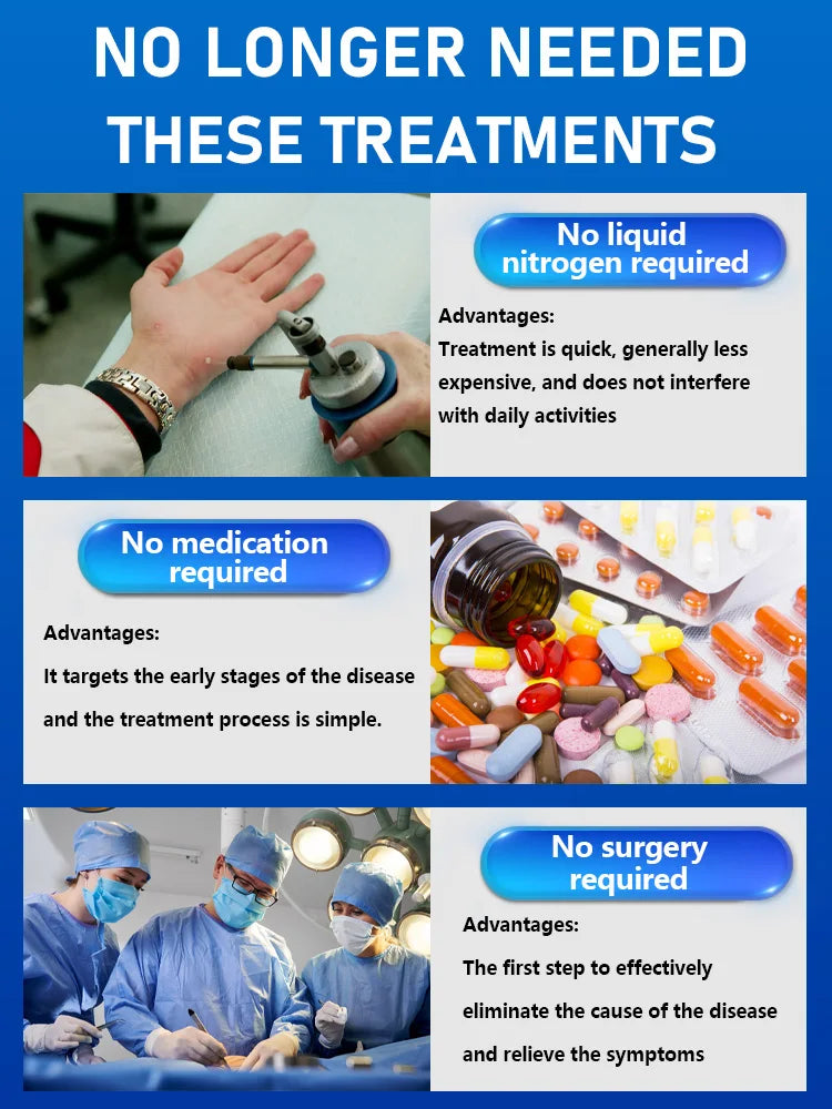 Fast Acting Wart Removal Liquid - Clinical Strength Skin Treatment Relaxation Treatment Tidesmit
