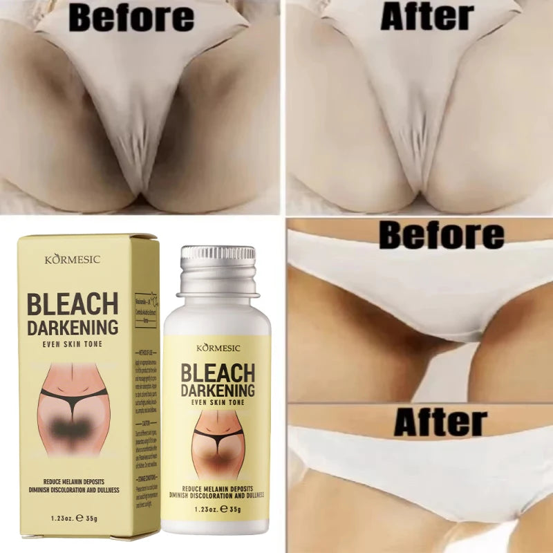 Body Whitening Cream Private Parts Underarm Dark Skin Bleaching Serum Niacinamide Whitening Lighten Dark Spots Snow Bleach Cream