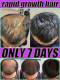 Hair Growth Spray - Nourishing Non-Greasy Formula for Faster Results Relaxation Treatment Buy 5 get 5 Free Tidesmit