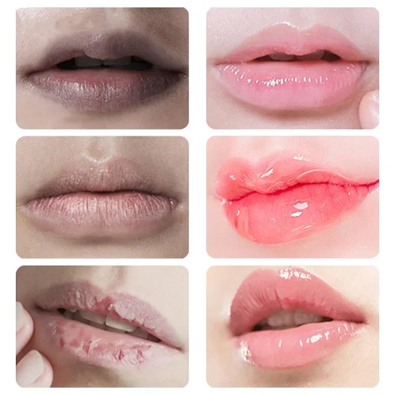 Lip Exfoliating Scrub for Dark Lips – Moisturizing Repair Balm Lip Care Tidesmit