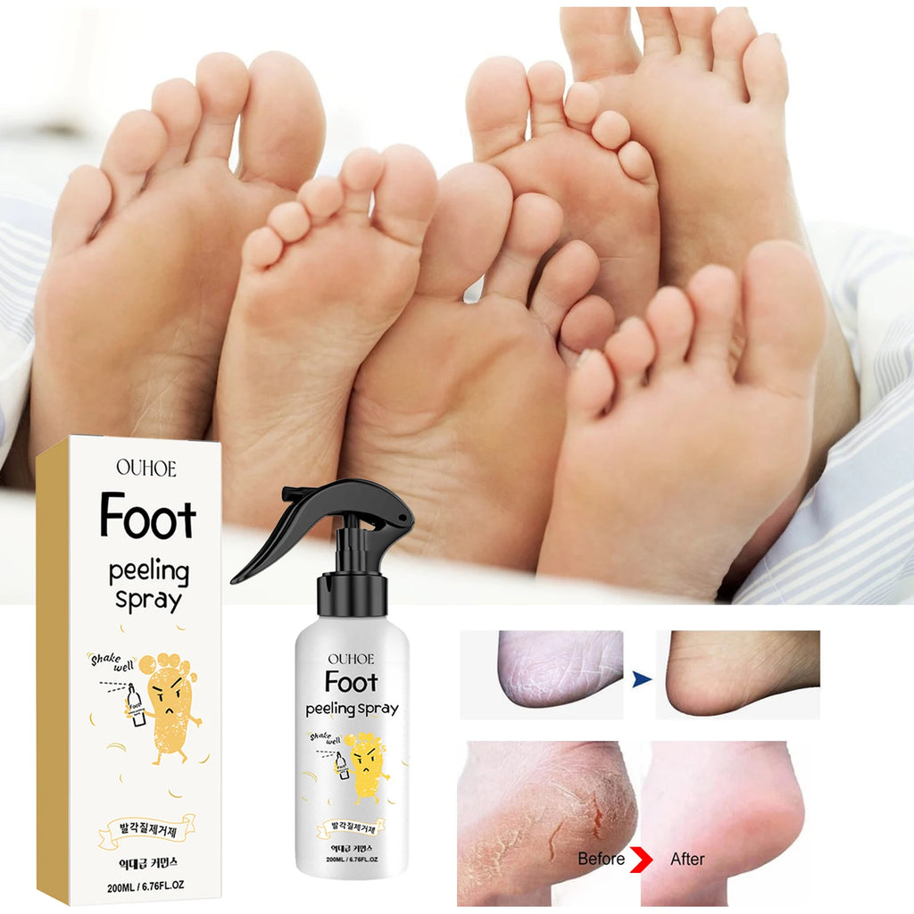 Foot Exfoliating Spray | Professional Callus Remover & Moisture Lock Scrubs Treatments Tidesmit