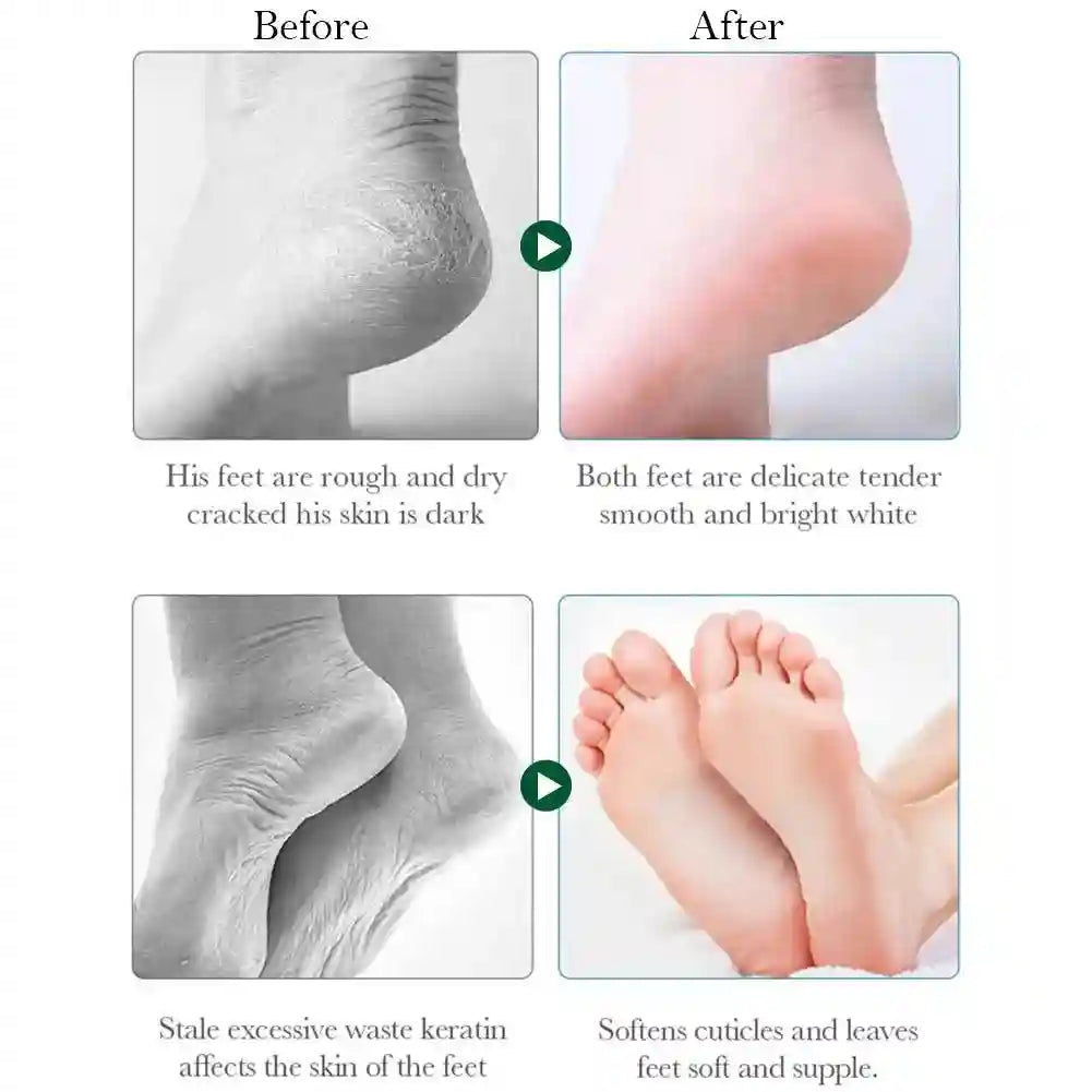 Vitamin E Foot Mask with Manuka Honey for Salon-Quality Soft Skin Scrubs Treatments Tidesmit