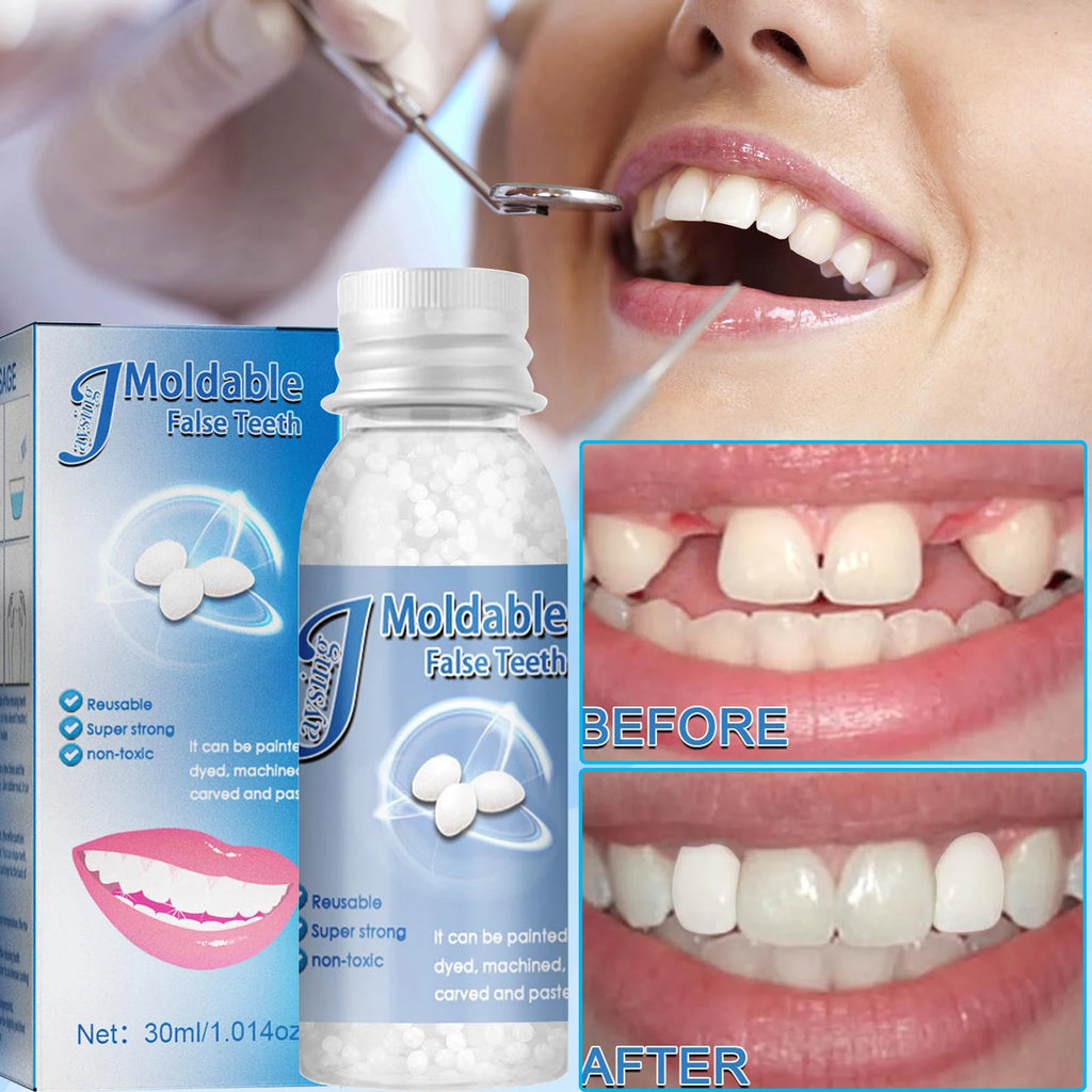 Temporary Tooth Repair Beads | Food Grade Dental Filling Material for Missing Broken Teeth, Denture Adhesive Solid Glue