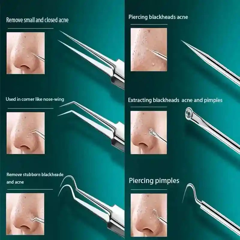 A set of stainless steel acne removal tools, including tweezers, extractors, and needles, shown in use on facial skin.