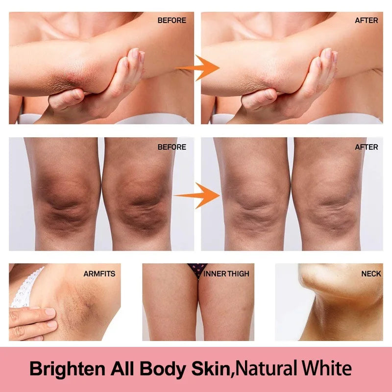 Body Whitening Niacinamide Brighten Cream For Intimate Parts Underarm Bleach Knees Lighten Thigh Inner Korean Skin Care Products